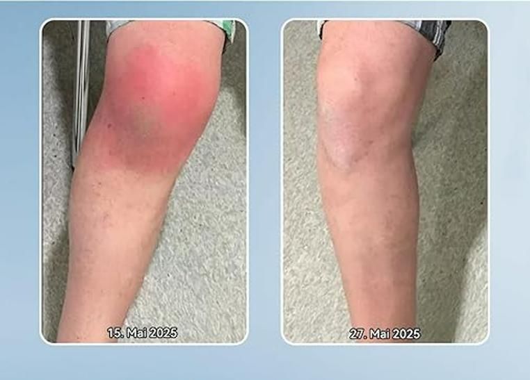 BPC-157 Gelenk-Helicreme 200 gm Pack of 2